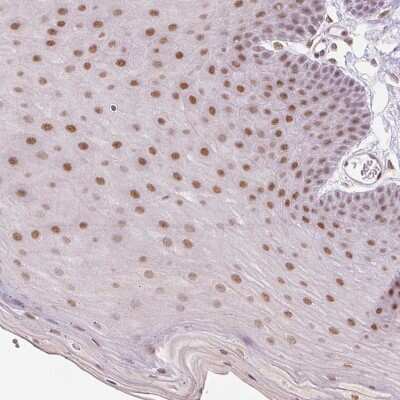 Immunohistochemistry-Paraffin: GRHL3 Antibody [NBP2-57087]