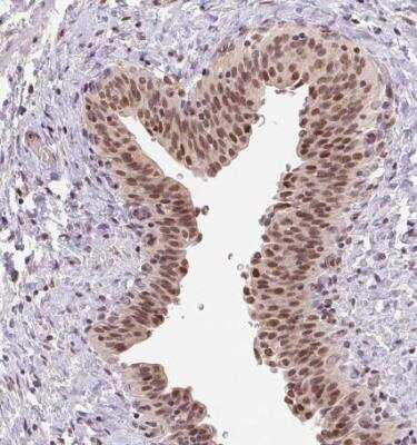 Immunohistochemistry-Paraffin: GRHL3 Antibody [NBP2-57087]