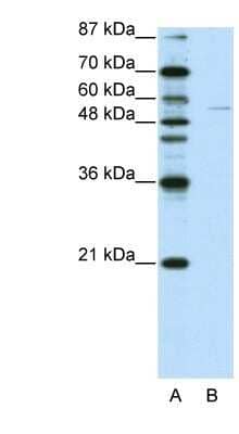 Western Blot: GRHL3 Antibody [NBP1-80355]