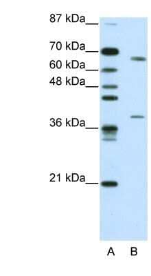 Western Blot: GRHL3 Antibody [NBP1-80356]