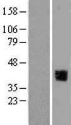 Western Blot: GRHL3 Overexpression Lysate [NBP2-04712]