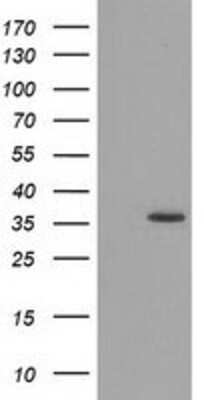 Western Blot: GRHPR Antibody (OTI2H4) [NBP2-03348]