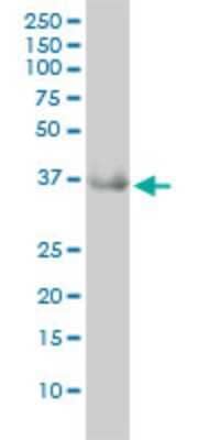 Western Blot: GRHPR Antibody (4E6-1F2) [H00009380-M01]