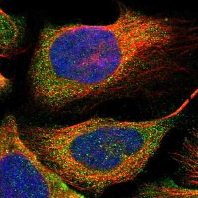 Immunocytochemistry/ Immunofluorescence: GRHPR Antibody [NBP1-83359]