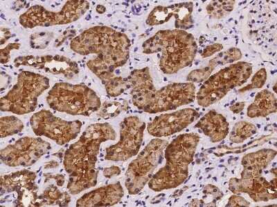 Immunohistochemistry-Paraffin: GRHPR Antibody [NBP2-97219]