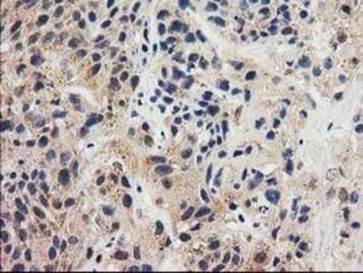 Immunohistochemistry: GRHPR Antibody (OTI2H4) - Azide and BSA Free [NBP2-71430]