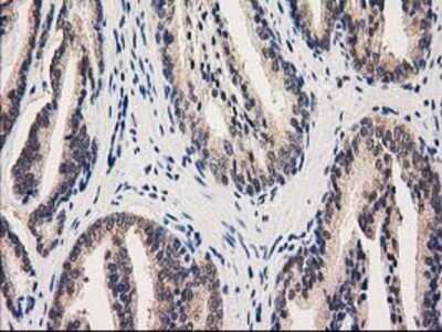 Immunohistochemistry: GRHPR Antibody (OTI2H4) - Azide and BSA Free [NBP2-71430]