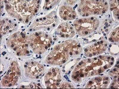 Immunohistochemistry: GRHPR Antibody (OTI2H4) - Azide and BSA Free [NBP2-71430]