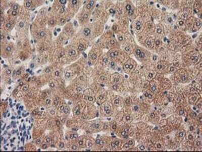 Immunohistochemistry: GRHPR Antibody (OTI2H4) - Azide and BSA Free [NBP2-71430]