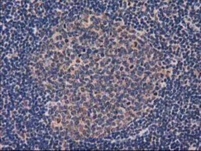Immunohistochemistry: GRHPR Antibody (OTI2H4) - Azide and BSA Free [NBP2-71430]
