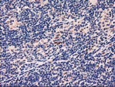 Immunohistochemistry: GRHPR Antibody (OTI2H4) - Azide and BSA Free [NBP2-71430]