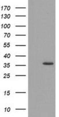 Western Blot: GRHPR Antibody (OTI2H4)Azide and BSA Free [NBP2-71430]