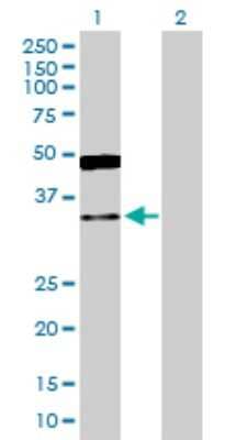 Western Blot: GRHPR Antibody [H00009380-D01P]