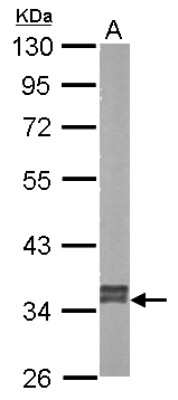 Western Blot: GRHPR Antibody [NBP1-32747]