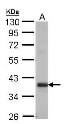 Western Blot: GRHPR Antibody [NBP1-32747]