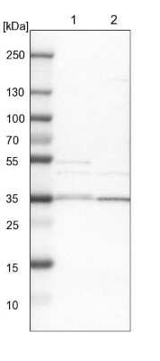 Western Blot: GRHPR Antibody [NBP1-83359]