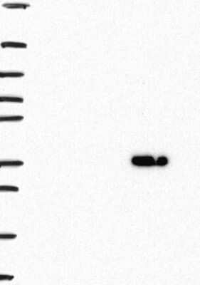 Western Blot: GRHPR Antibody [NBP3-17036]