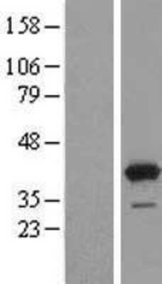 Western Blot: GRHPR Overexpression Lysate [NBL1-11334]