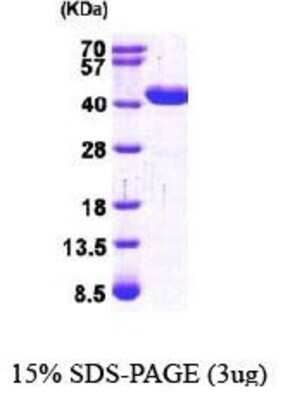 SDS-PAGE: Recombinant Human GRHPR His Protein [NBP1-44463]