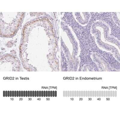 Immunohistochemistry-Paraffin: GRID2 Antibody [NBP2-31632]