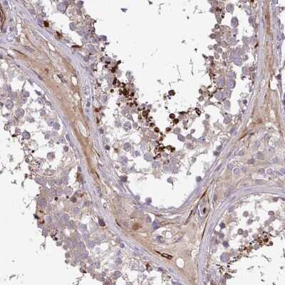 Immunohistochemistry-Paraffin: GRID2 Antibody [NBP2-31723]