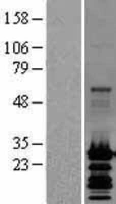 Western Blot: GRIM19 Overexpression Lysate [NBL1-13538]