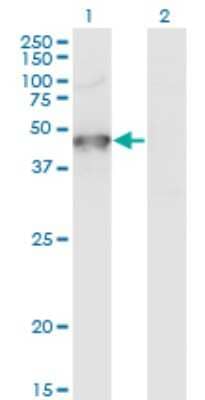 Western Blot: GRINL1A Antibody (2E4) [H00081488-M04]