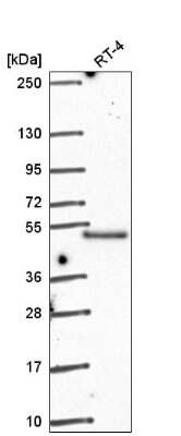 Western Blot: GRINL1A Antibody [NBP2-57432]