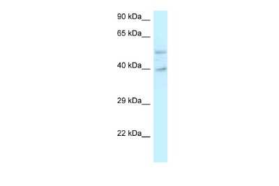 Western Blot: GRINL1A Antibody [NBP2-85016]