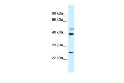 Western Blot: GRINL1A Antibody [NBP2-85017]