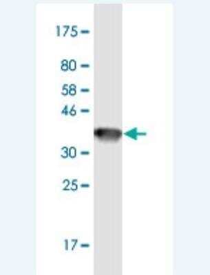 Western Blot: GRIP1 Antibody (4A9) [H00023426-M05-100ug]