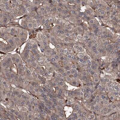 Immunohistochemistry-Paraffin: GRIP1 Antibody [NBP1-86252]