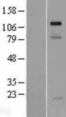 Western Blot: GRIP1 Overexpression Lysate [NBP2-06558]