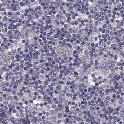 Immunohistochemistry-Paraffin: GRK1 Antibody [NBP2-55226]