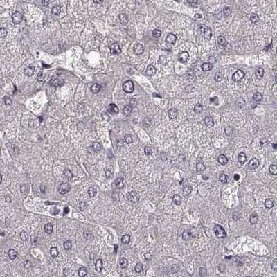 Immunohistochemistry-Paraffin: GRK1 Antibody [NBP2-55226]