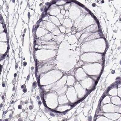 Immunohistochemistry-Paraffin: GRK1 Antibody [NBP2-55226]
