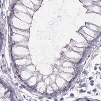 Immunohistochemistry-Paraffin: GRK1 Antibody [NBP2-55732]