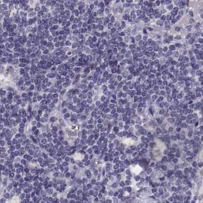 Immunohistochemistry-Paraffin: GRK1 Antibody [NBP2-55732]