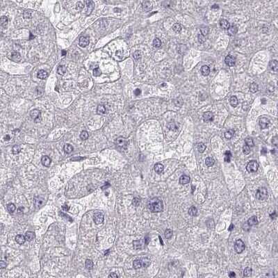 Immunohistochemistry-Paraffin: GRK1 Antibody [NBP2-55732]