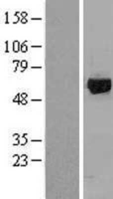 Western Blot: GRK1 Overexpression Lysate [NBL1-11342]