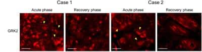 Immunohistochemistry: GRK2 Antibody (3F8) - BSA Free [NBP2-37611]