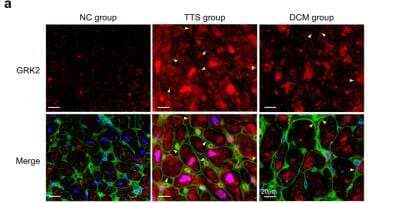 Immunohistochemistry: GRK2 Antibody (3F8) - BSA Free [NBP2-37611]