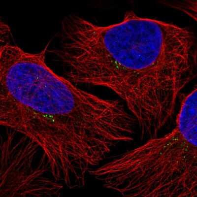 Immunocytochemistry/ Immunofluorescence: GRK2 Antibody [NBP2-57283]