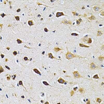 Immunohistochemistry-Paraffin: GRK2 Antibody - BSA Free [NBP3-03731]