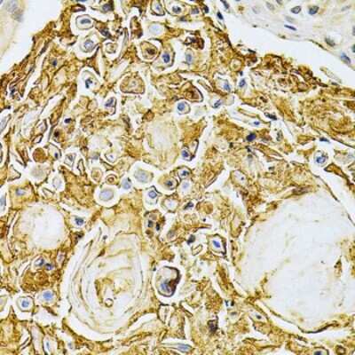 Immunohistochemistry-Paraffin: GRK2 Antibody - BSA Free [NBP3-03731]