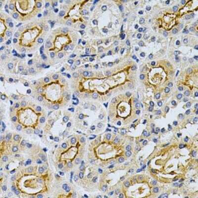 Immunohistochemistry-Paraffin: GRK2 Antibody - BSA Free [NBP3-03731]