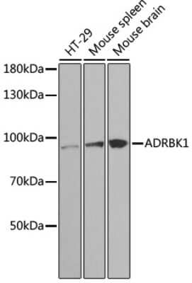 Knockout Validated: GRK2 Antibody - BSA Free [NBP3-03731]