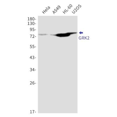 Western Blot: GRK2 Antibody (S01-6I5) [NBP3-20067]