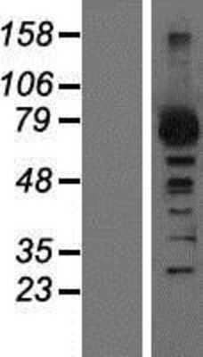 Western Blot: GRK2 Overexpression Lysate [NBP2-10984]