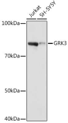 Western Blot: GRK3 Antibody (10O6S3) [NBP3-16772]